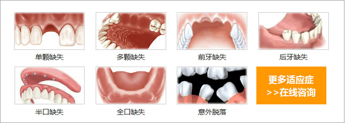 种牙